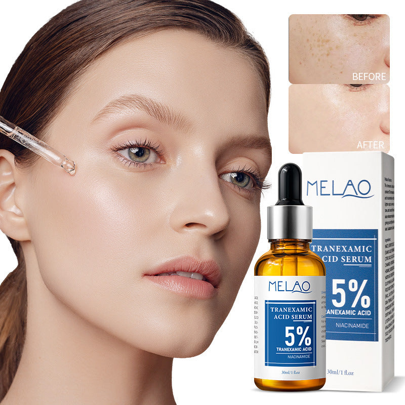 Solution de soins solution acide tranexamique éclaircissant la couleur de la peau