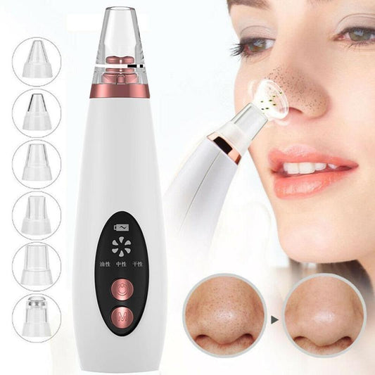 Aspirateur de points noirs pour nettoyer le nez, enlever les points noirs et l'acné, avec bouton de succion pour le visage, outil de soin de la peau - Ivory Deals Market