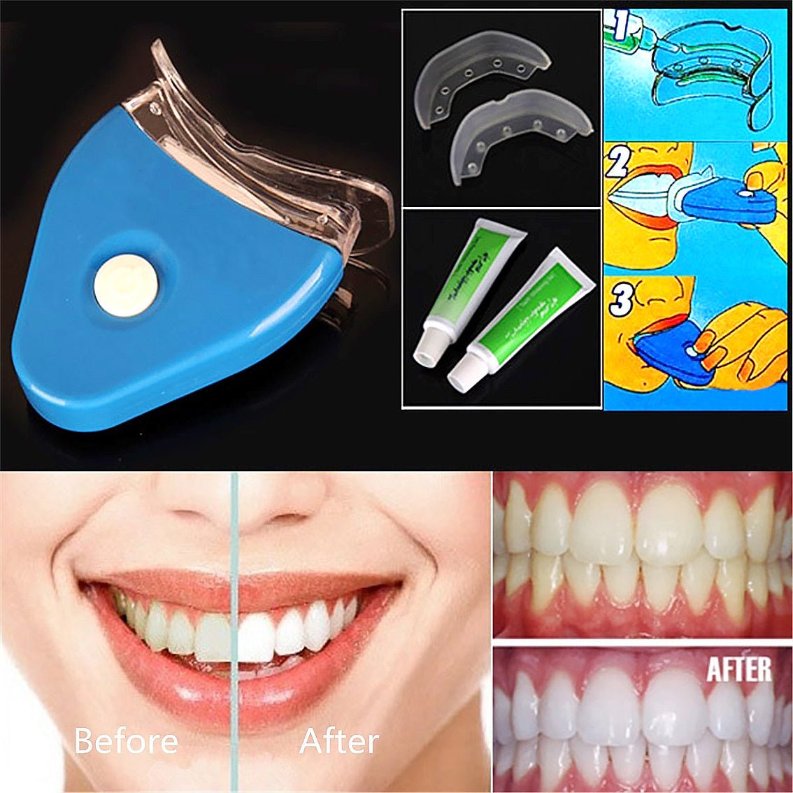 Gel oral pour blanchiment des dents avec LED - Ivory Deals Market